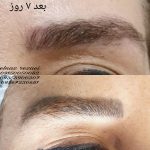 پاک کردن تاتو ابرو