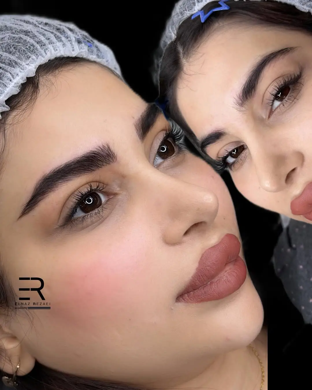 میکروبلیدینگ مشهد الناز رضایی