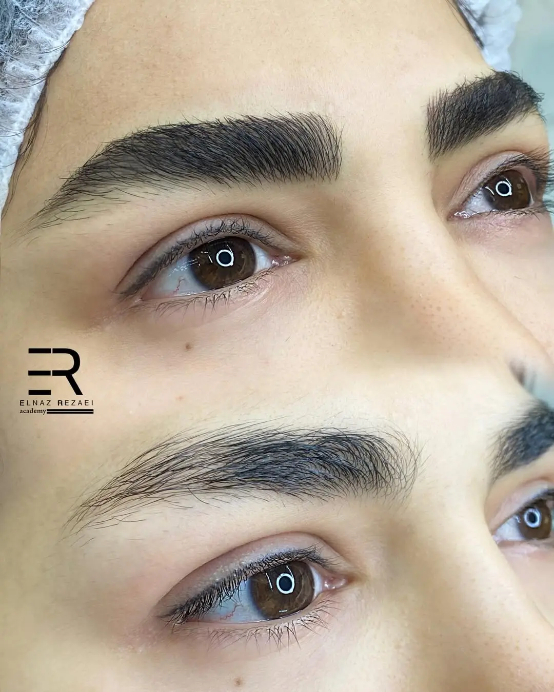 میکروبلیدینگ طبیعی مشهد