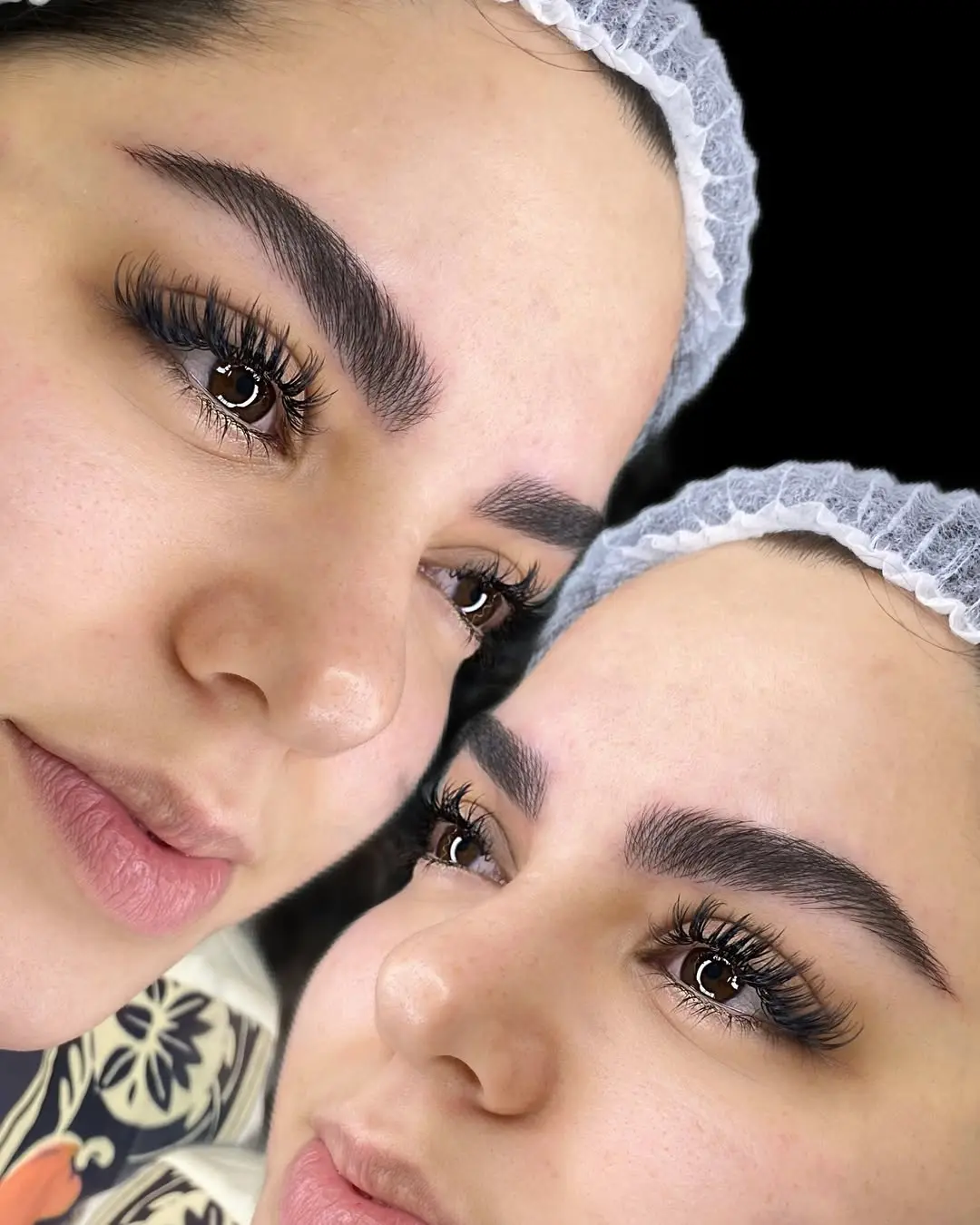 ترمیم ابرو مشهد